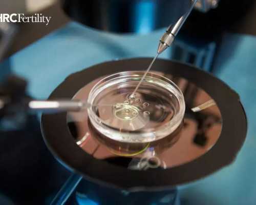 香港医院验血中介_验血是女孩引产下来男孩?需要注意的都在这!