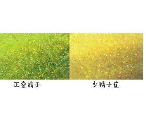 厦门寄香港验血的好多,美国试管婴儿能避免宫外孕吗 出现宫外孕的几种情况