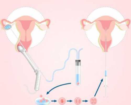 香港验血多久能出结果_香港验血能查出男女性别吗_怎么预约香港验血机构