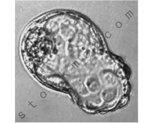 香港验血情绪波动会影响结果吗_香港验血测男女哪个机构好邮寄_性别鉴定几周
