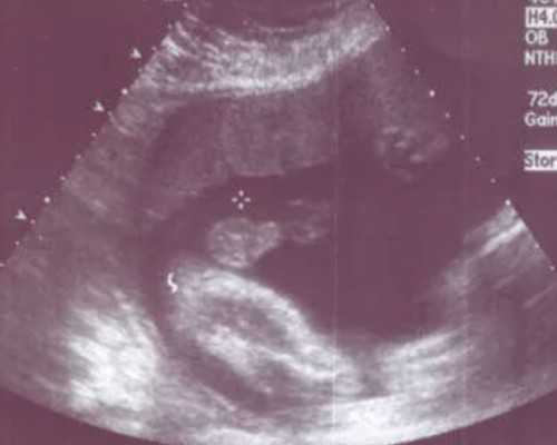 怀孕香港验血该找谁_怀孕多久后可以去香港查男女_7周香港验血查男女准不