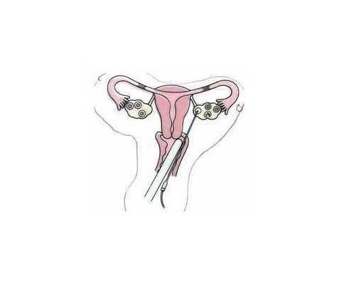 杨秀山香港验血准吗_香港验血性别条件邮递哪家比较好