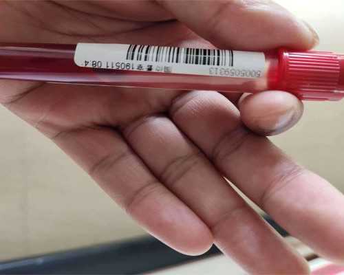 三门峡古玩市场_头疼吐黄水苦水是怎么回事