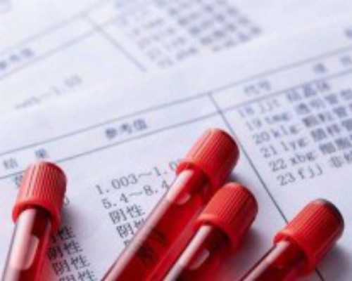 山东聊城古玩城大集_7个生活窍门减肥事半功倍