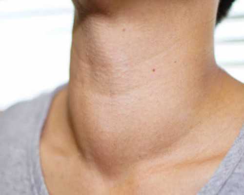 邮寄香港验血没有Y 是男孩女孩_去香港验血带Y_查男女需要什么条件!