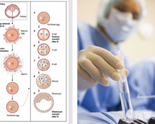 西安有没有古玩鉴定的,在什么地方,阴道炎物理治疗