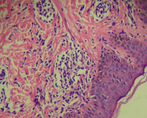 香港验血哪家更精准,备孕男孩男人吃酸性还是碱性食物