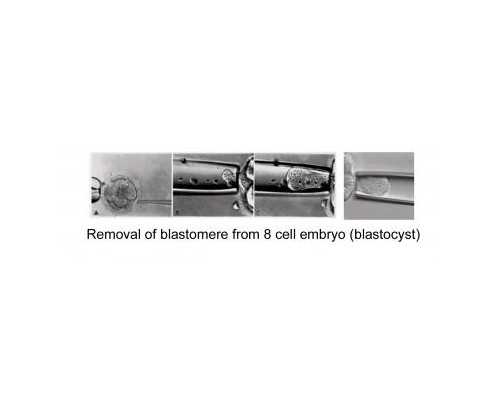 香港格兰中心 验血正规吗_香港验血为什么要抽二管血_验血是男孩竟然翻盘!