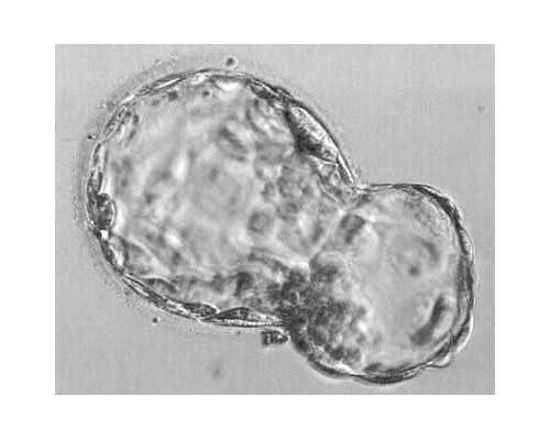 香港理想基因有限公司 验血男女 准确吗_香港dna预约中心可靠吗_你想知道的都