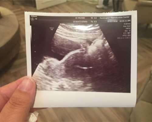 香港验血星期六日出结果吗_书香伴我行中的香是什么意思“书香伴我行”的演