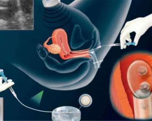 香港验血鉴定男女16周可以验吗_7周香港检测性别是否真的?想知道，有必要学会