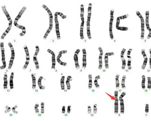 古董古玩鉴定拍卖交易_夏季吃海鲜过敏怎么办