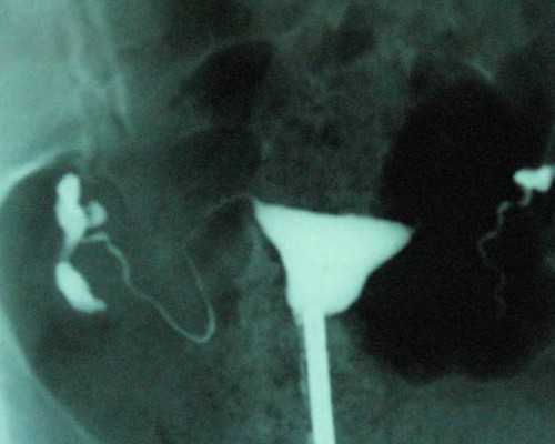 香港验血快递3天行么_关于描写秋天的作文四年级描写秋天的作文题目