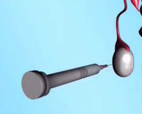 怀孕胚芽8mm可以香港验血,卵泡少能做试管吗？