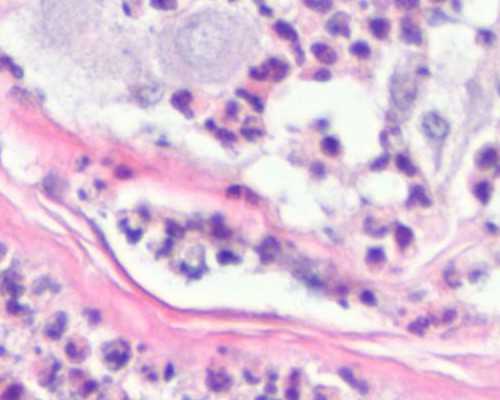 怎么做香港孕妇验血,泰国试管婴儿中介机构多，如何挑选?