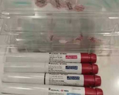 李成儒演的电视剧收藏古玩的有什么电视_盘点秋季吃什么对皮肤好