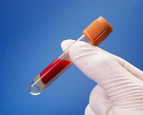 香港验血鉴定几周_深圳西乡香港验血_多久能出结果