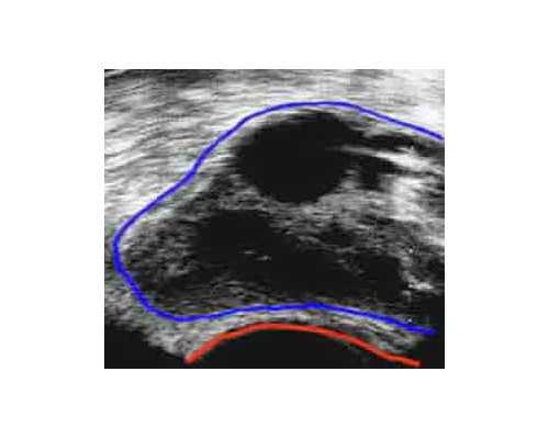 香港验血结果几天出结果_香港验血阴性代表什么意思_有去香港验血翻盘的吗
