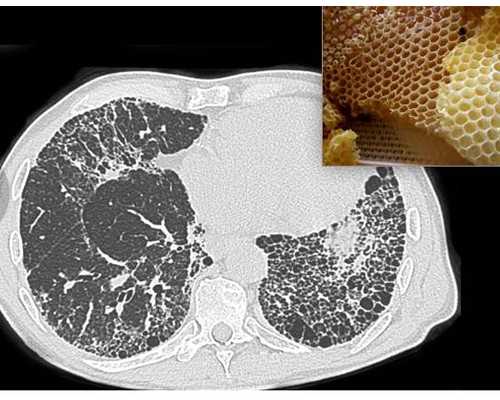 怀孕多久才能香港验血_香港查男女准确率_不贵，只要2600是真的吗