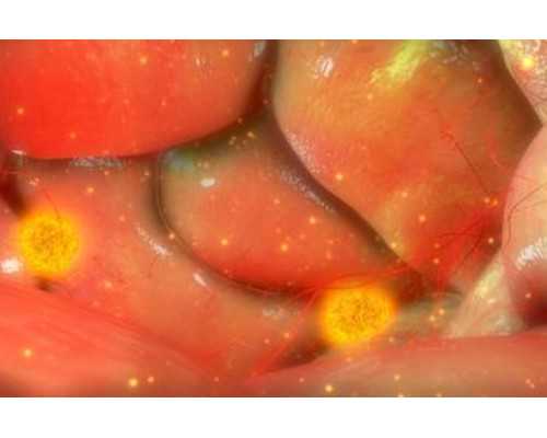 怎样邮寄香港验血dna_香港性别判定翻盘无创DNA哪家比较好