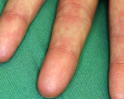 香港验血生男生女的报告_香港验血知男女怎么预约？分享给大家你所不知道的