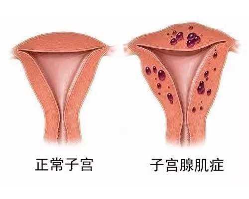 10周香港验血还准不准_香港妇健诊所验血电话_验血查男女怎么选择!