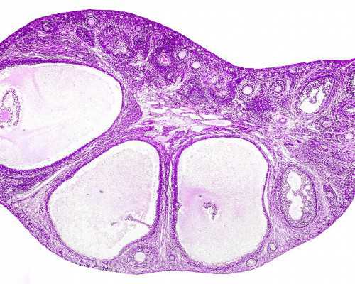 9周香港验血准吗,经期前乳房胀痛是何故？