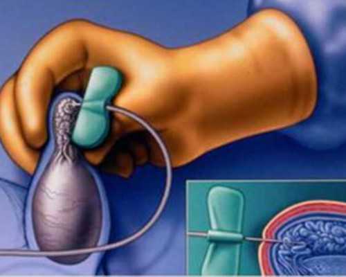 香港验血几天能结果_香港验血查性别有不准的吗_验血和B超都是男孩_还会翻盘