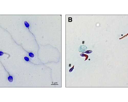 香港怀孕六周能验血吗_哪里有六周查男女单位百分百牢靠