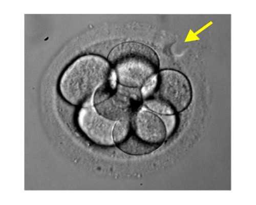 香港验血怀孕几周可以验,试管婴儿和自然受孕，孩子有什么差距吗？其实区别