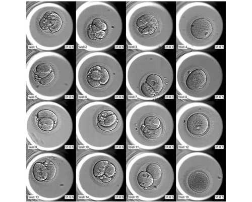 古玩铲地皮是什么意思_东京山种美术馆重新开馆 品读画笔下的樱花