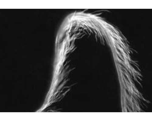 香港 验血查男女准吗_香港验血查性别会出错吗_报告单Y染色体呈阳性就是男孩