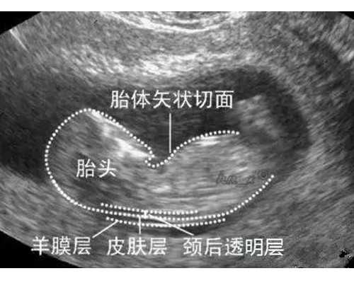 香港验血准妈_作文：《寻找身边的雷锋》寻找身边的雷锋广播稿