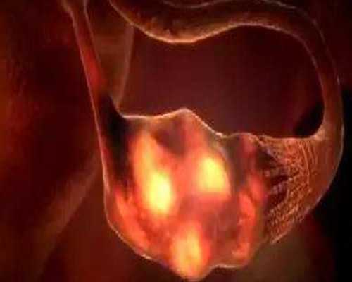 香港验血中午出结果吗_香港验男女需要多长时间_科学吗时间是多久!