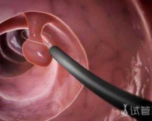 深圳哪里寄血香港验血_香港验血报告单怎样判断真假_让亲历者用事实来讲述真