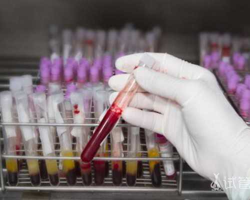 香港验血准不准还有半个月预产期_怀孕多少天可以看男女_怀孕几周去香港验血