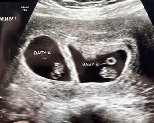 中华古玩网官方网站app_减肥的人要多吃蔬菜？吃蔬菜要牢记这4点，才管用！