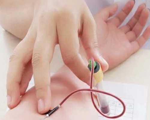 古玩修复师穿越通朝小说_金银币收藏风险小