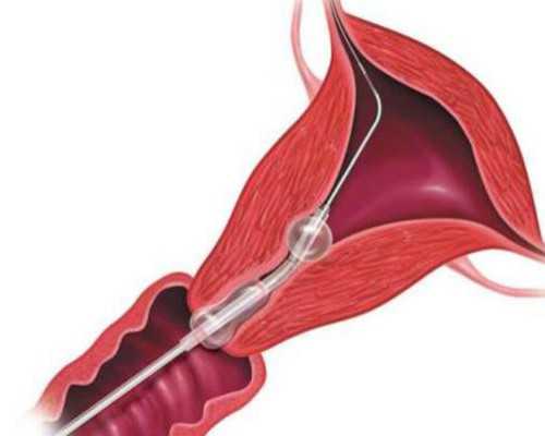 3千元香港验血准吗,泰国试管婴儿是怎么做的，赴泰做试管的详细流程