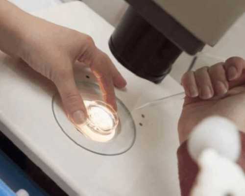 怀孕两个月香港验血性别准吗,高龄、试管、子宫肌瘤、甲减……这位孕妈妈值