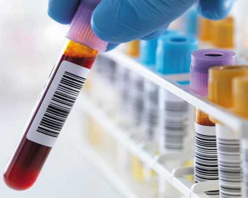 香港验血几周去验_香港验血中介杨姐准不准_详细的步骤都在这!