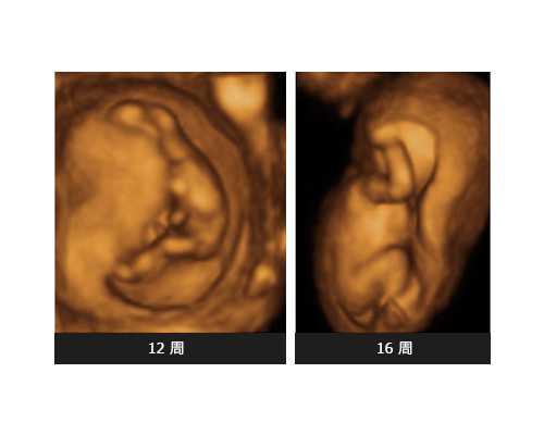 古玩大亨漠北狂生txt下载下载免费下载_哪些食物吃不胖还能减肥