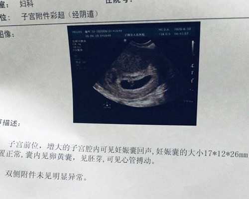古董古玩私下交易平台上门收购_狮子女哪里吸引水瓶男狮子女如何追水瓶男