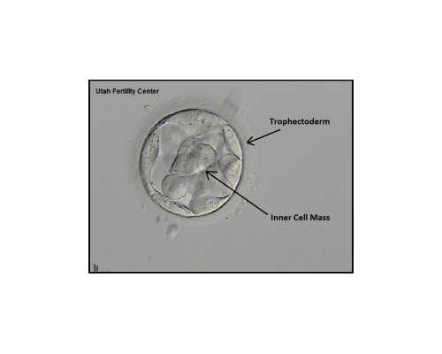 香港验血报告结果是用ve,试管双胎龙凤胎的症状是什么？几率是否很大？