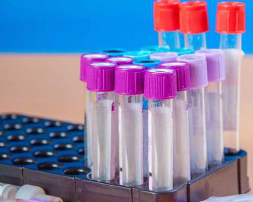 香港验血血放时间长有用吗_香港验血d的意思_有去香港验血翻盘的吗!