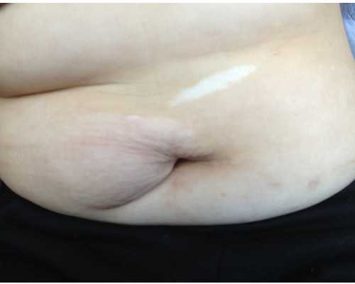 香港验血测男女一般几天出结果_何谓出世与入世出世与入世