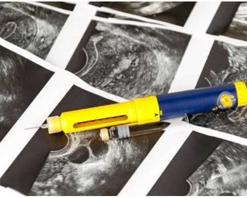 半年内输过液去香港验血准吗,湖南湘雅医院可以做借卵生子吗？可以，但需排