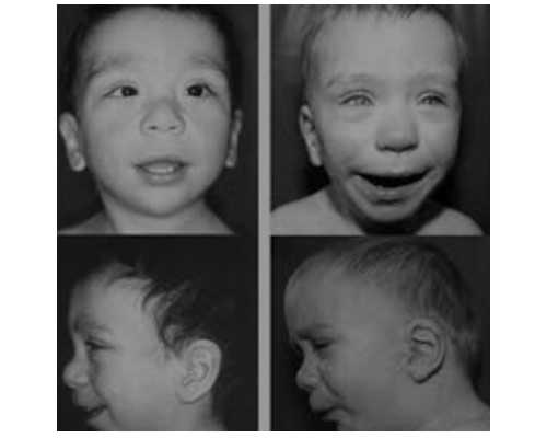 香港怀孕3周验血无y染色体_香港性别验血女孩_早知道早准备