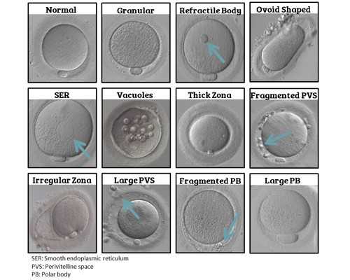 香港验血结果明天出来 好紧张_香港验血六周准确率低_验血查性别需要什么条件