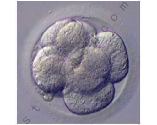 香港验血hkv服务机构,高龄产妇备孕前需要锻炼吗？怎么锻炼好
